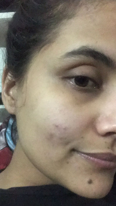 Before Shikha
